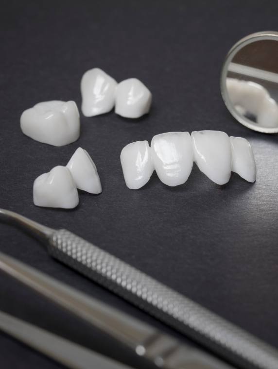 Several white dental crowns and veneers on tray next to dental mirrors