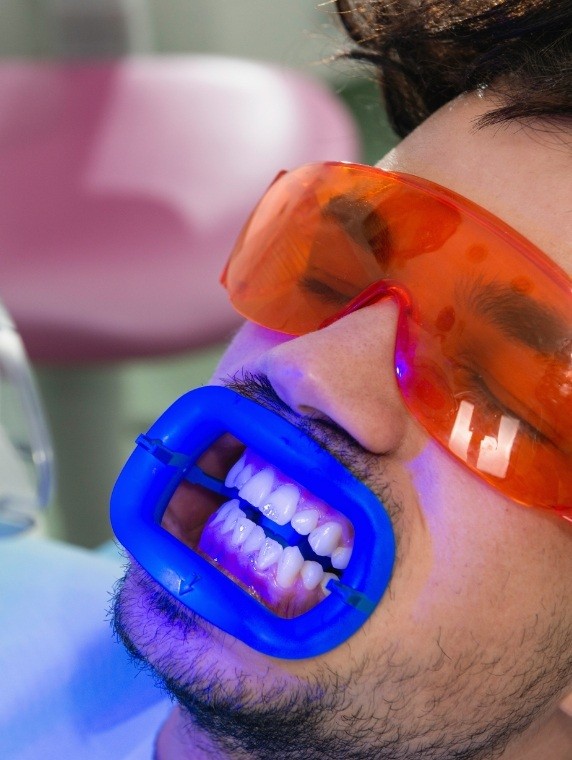 Dental patient getting his teeth professionally whitened