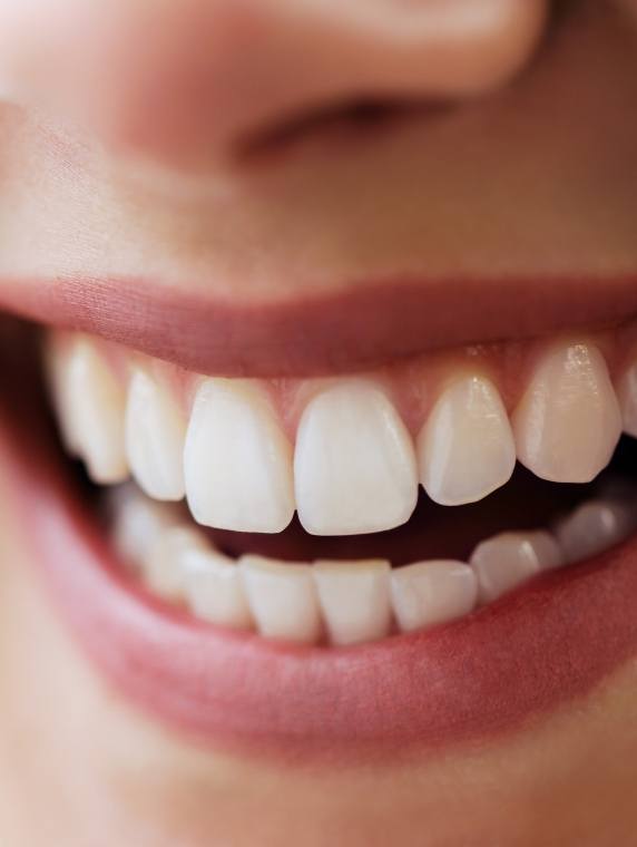 Close up of smile with flawlessly straight white teeth