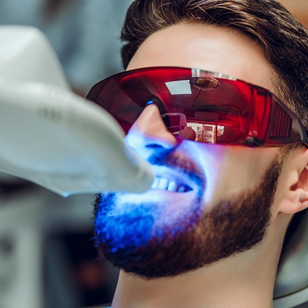 Teeth whitening costs range depending on the type of whitening used